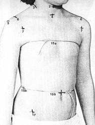anthrometric landmarks